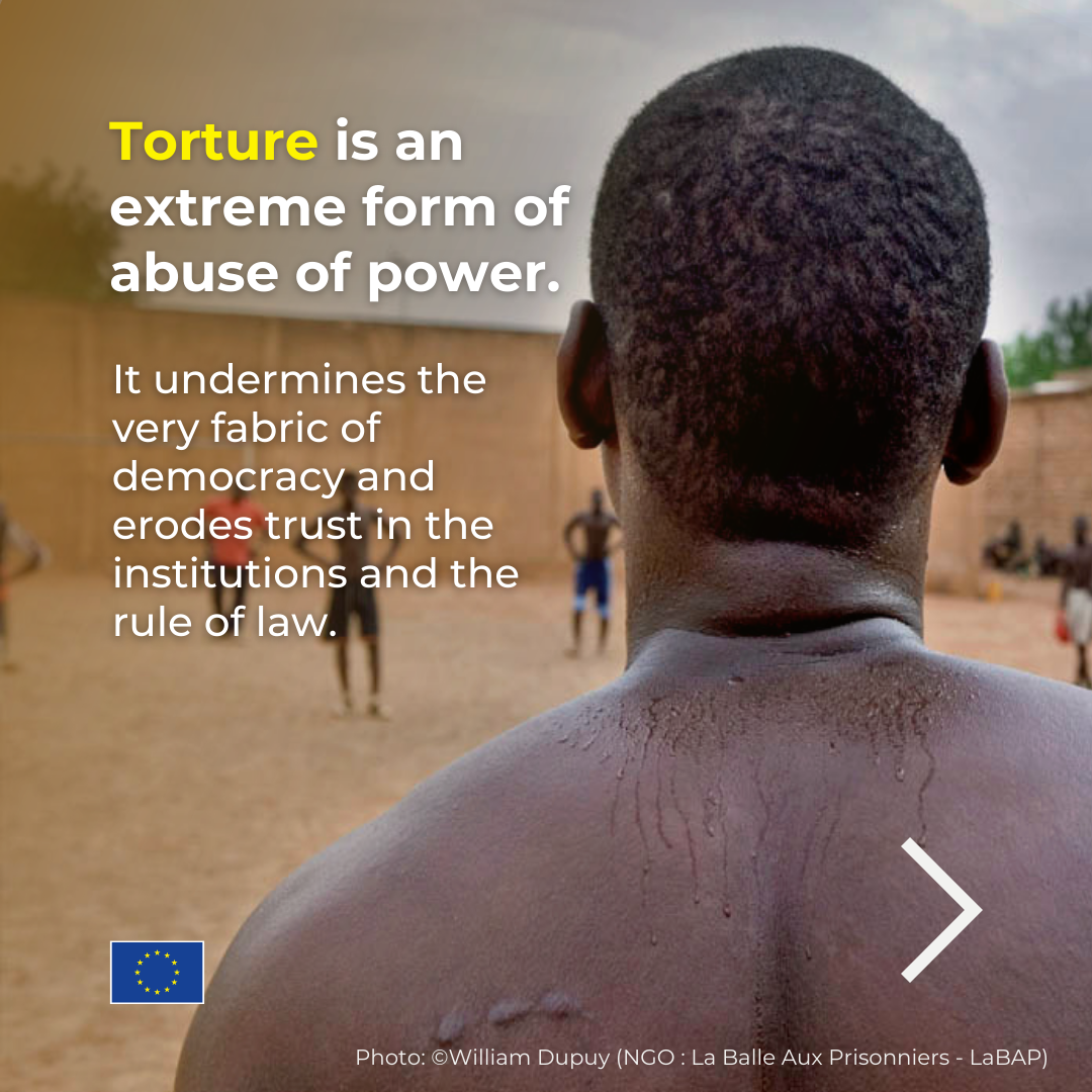 Torture is an extreme form of abuse of power